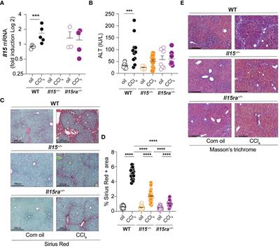 Profibrogenic role of IL-15 through IL-15 receptor alpha-mediated trans-presentation in the carbon tetrachloride-induced liver fibrosis model